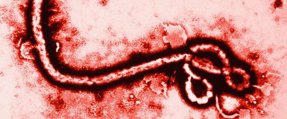 ebola virus